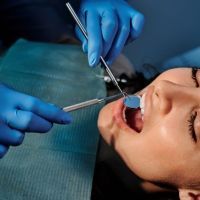 Liste de dentistes à Bordeaux pour vos soins dentaires